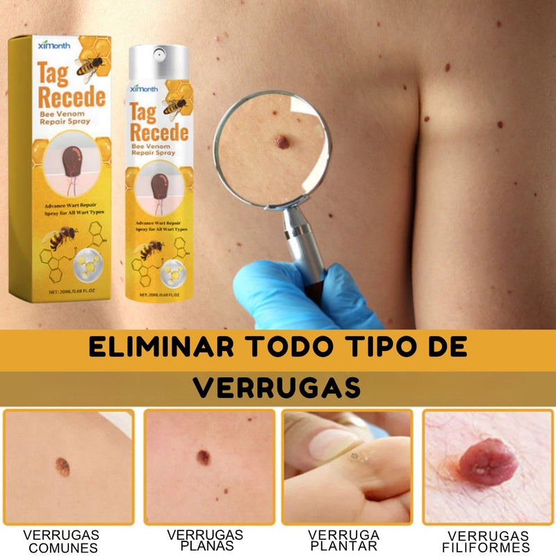 TAG RECEDE - Eliminador De Verrugas (Compra 1 y Lleva 2)